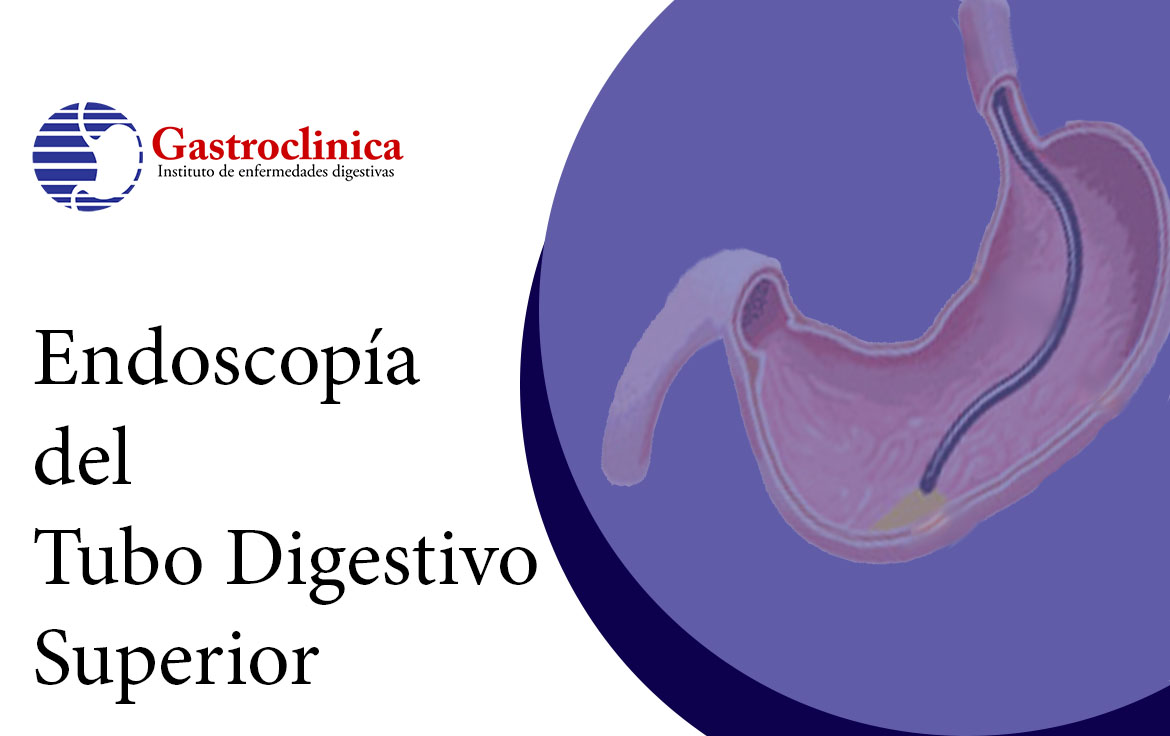 Endoscopía del Tubo Digestivo Superior